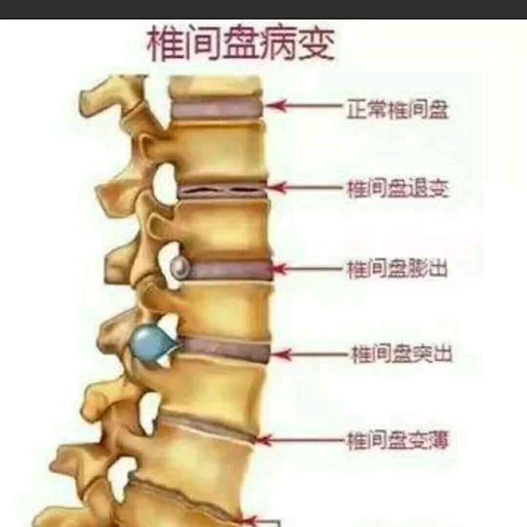 黄瑞勋在汪那屯