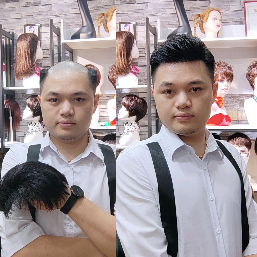 郴州市北湖区顶尚假发补发店