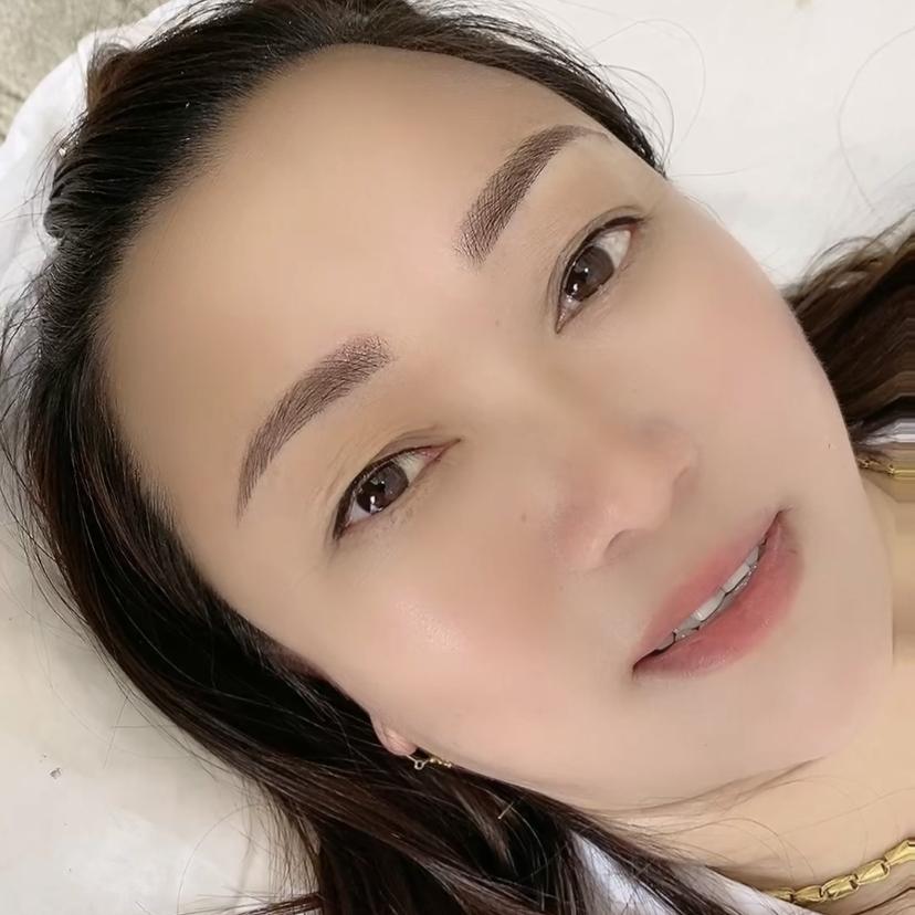 易琼