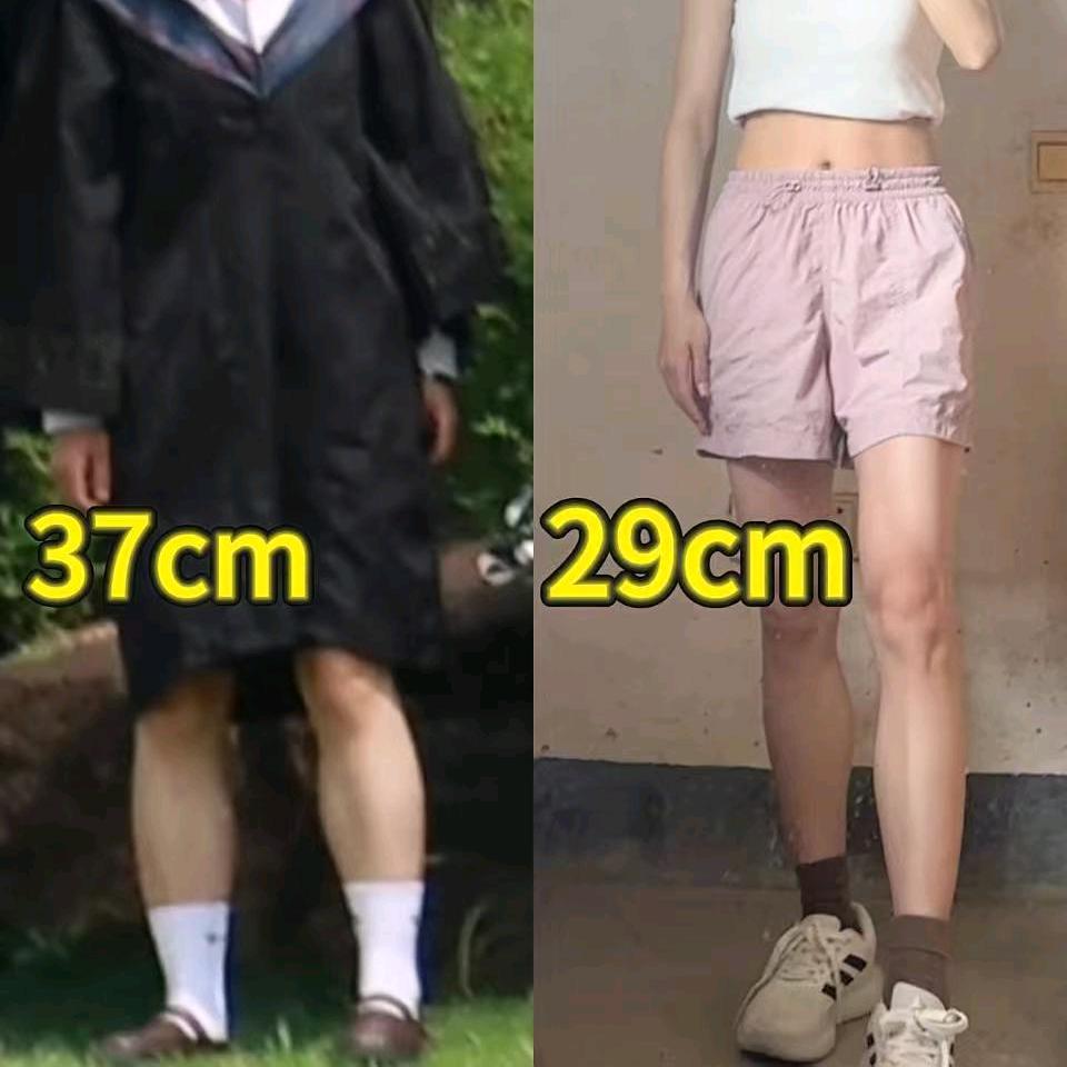 美腿林七七