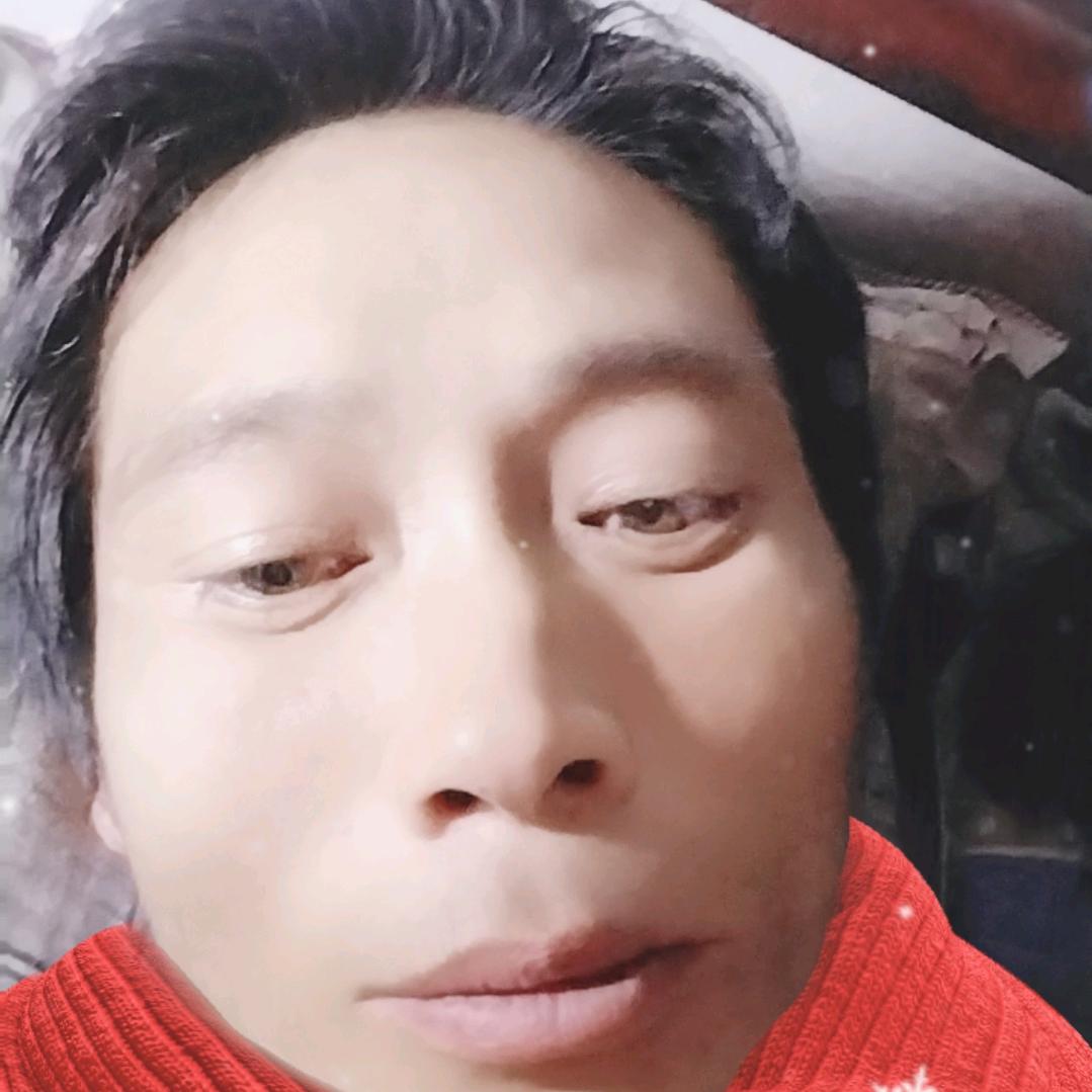 サーバ、ああ
