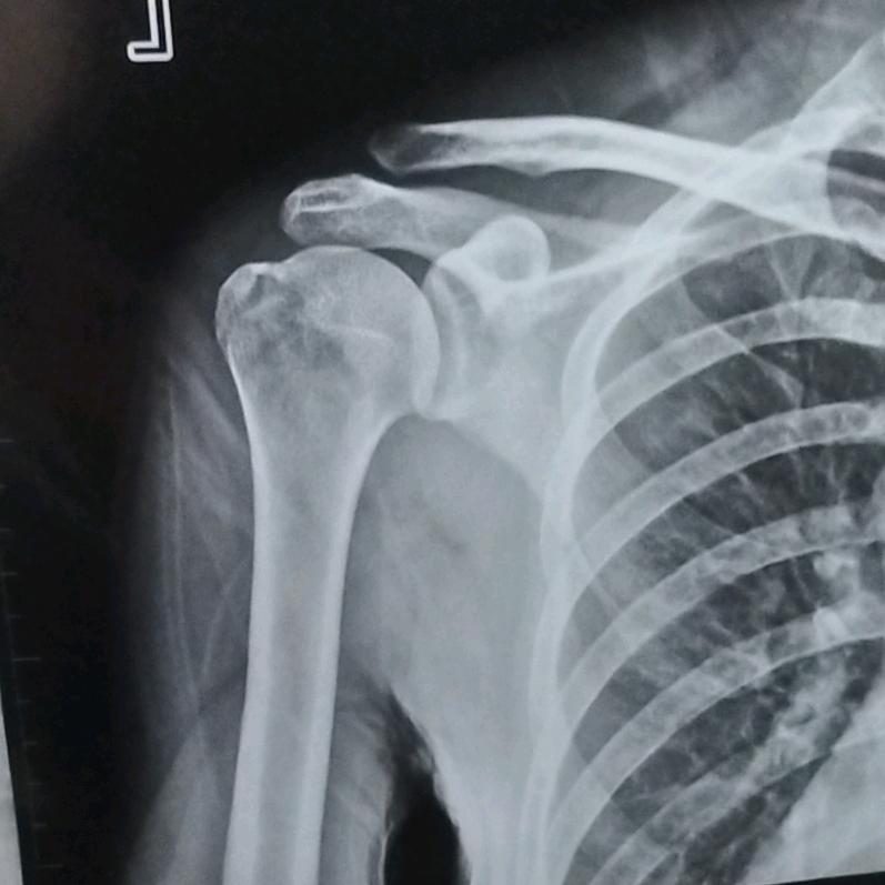 ←_←林（｡ò ∀ ó｡）夕→_→六月雪