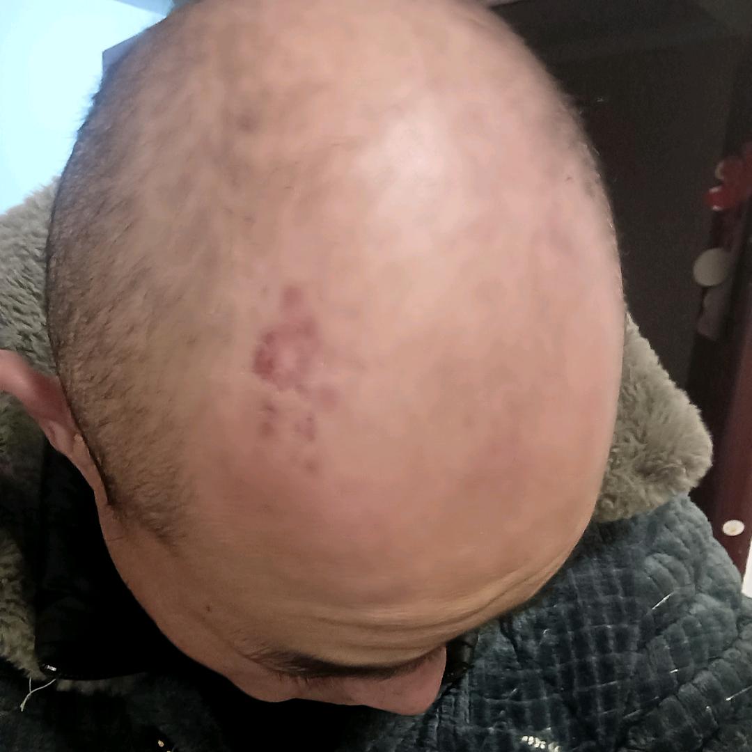 励志养发故事（徐峰指导）