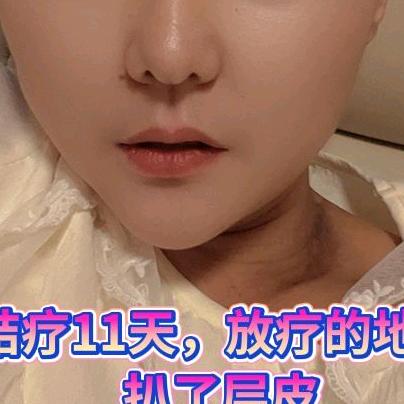 小蓉