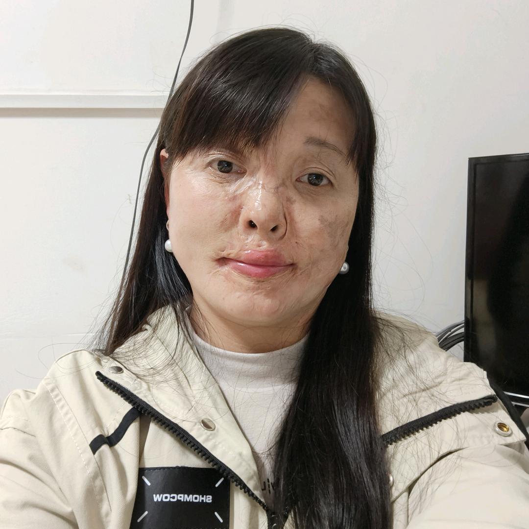阳光梅姐