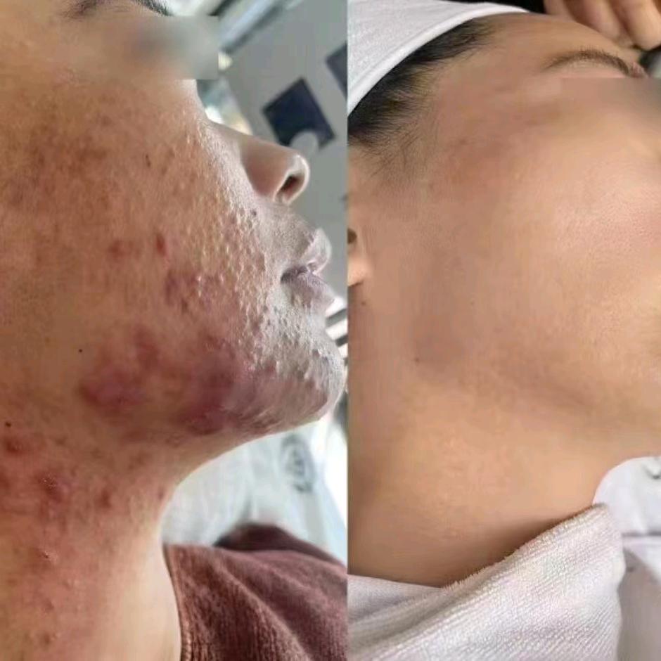 专业皮肤养护+抗衰