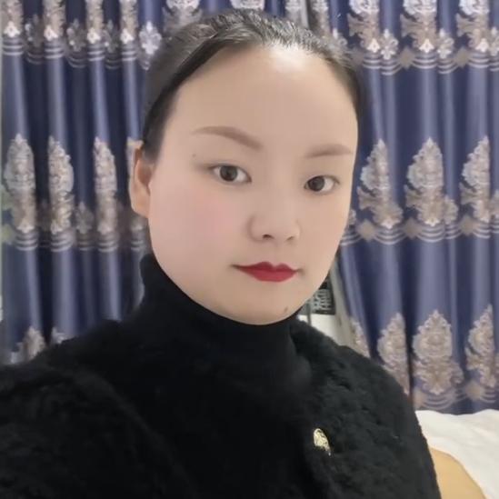 贵阳斑敏痘终结者徐妹