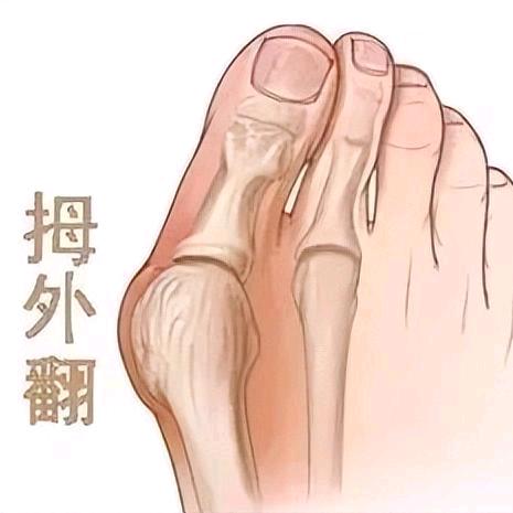 足部健康杨教练