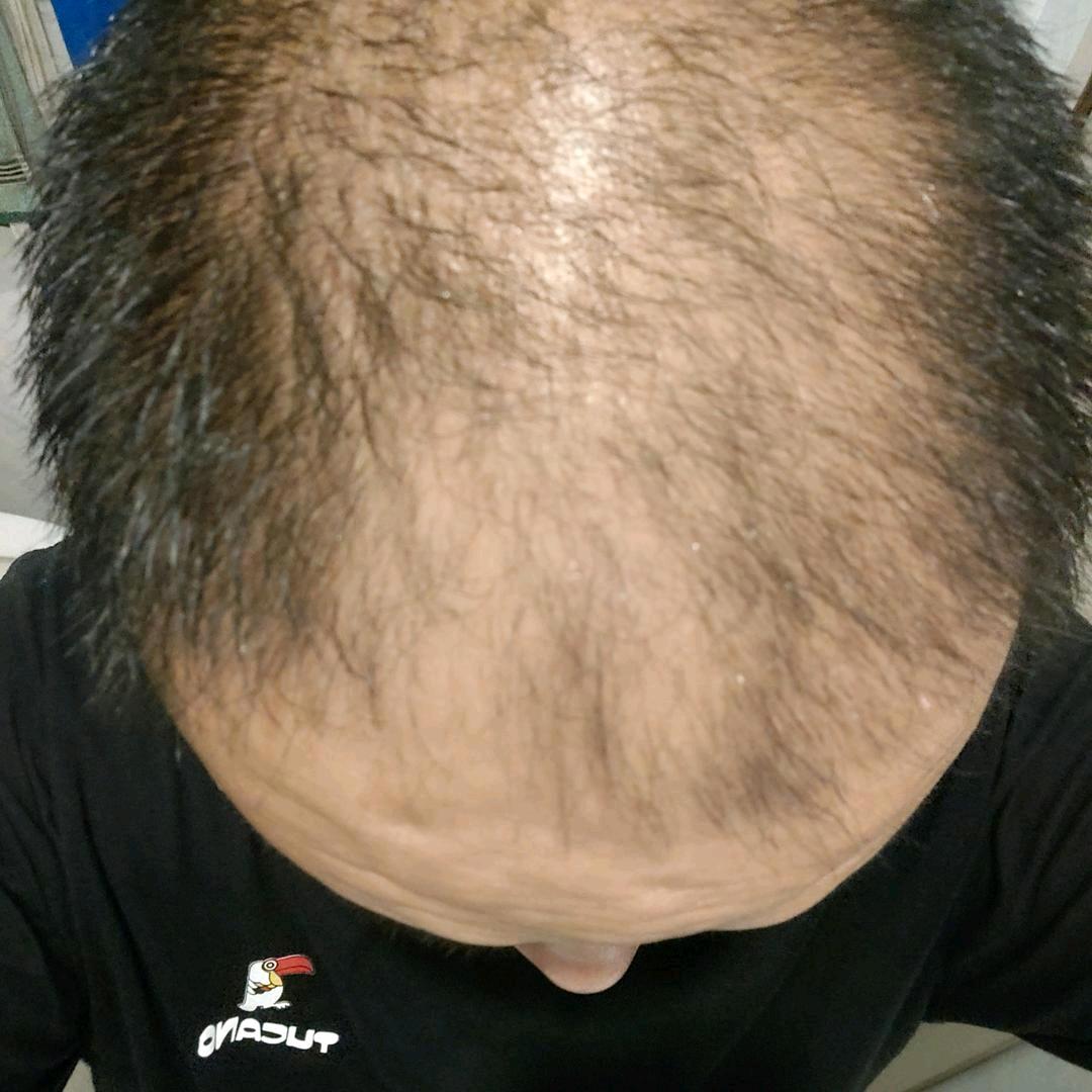哈哈邵的养发日记