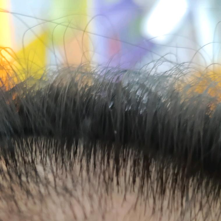 小白瓶白发转黑发