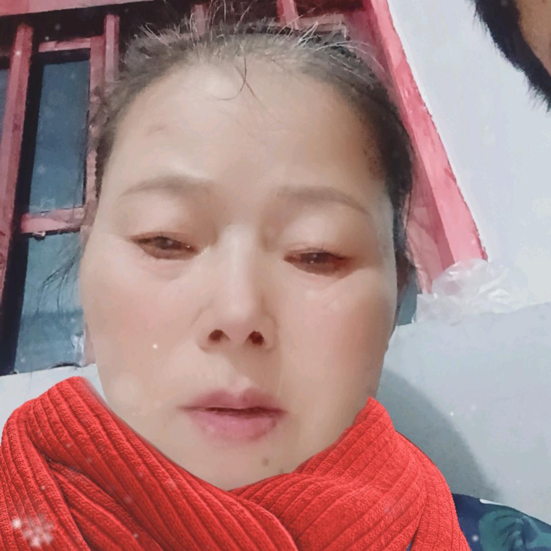 张怀琴