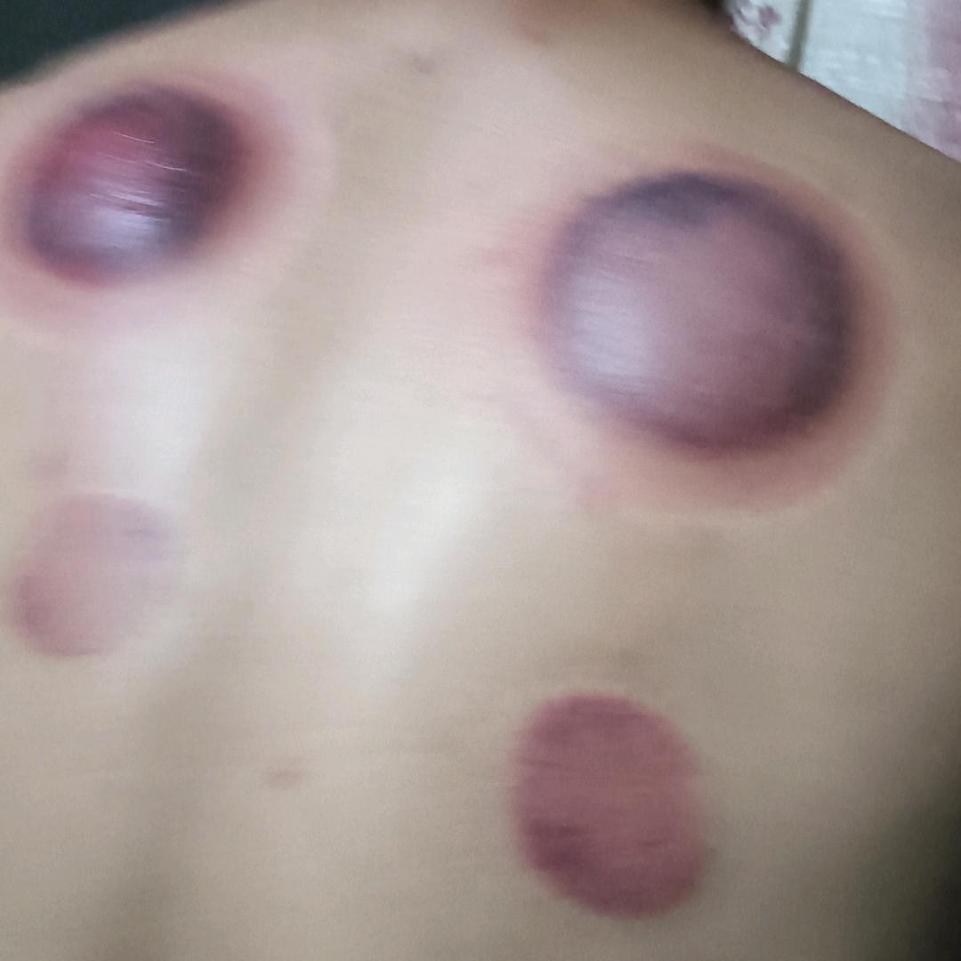单身怕生病。