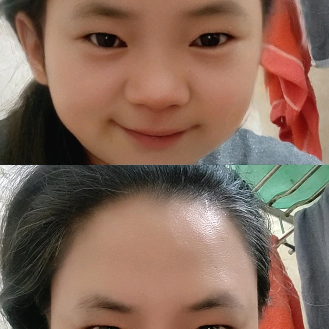 阿红