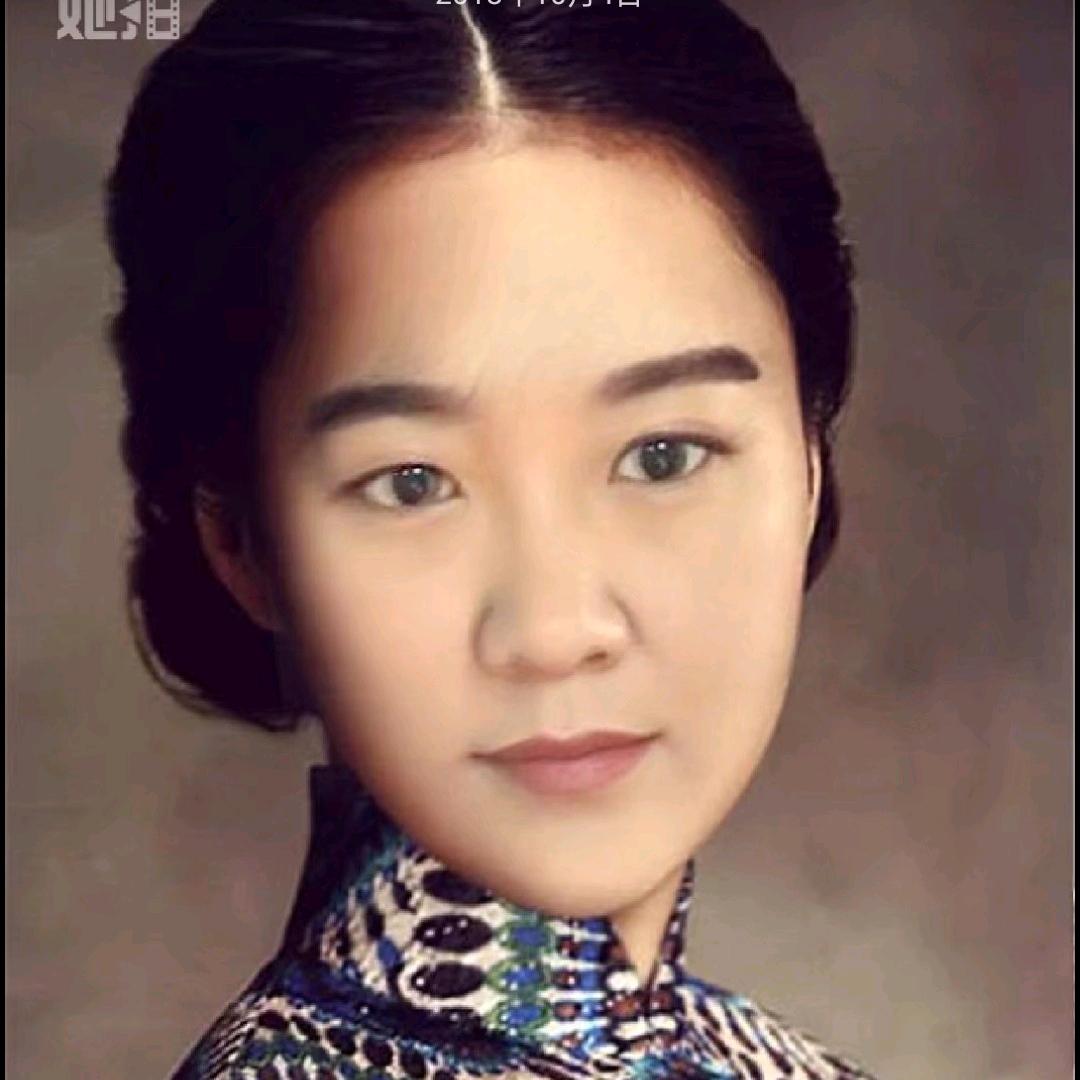 CD代谢管理
