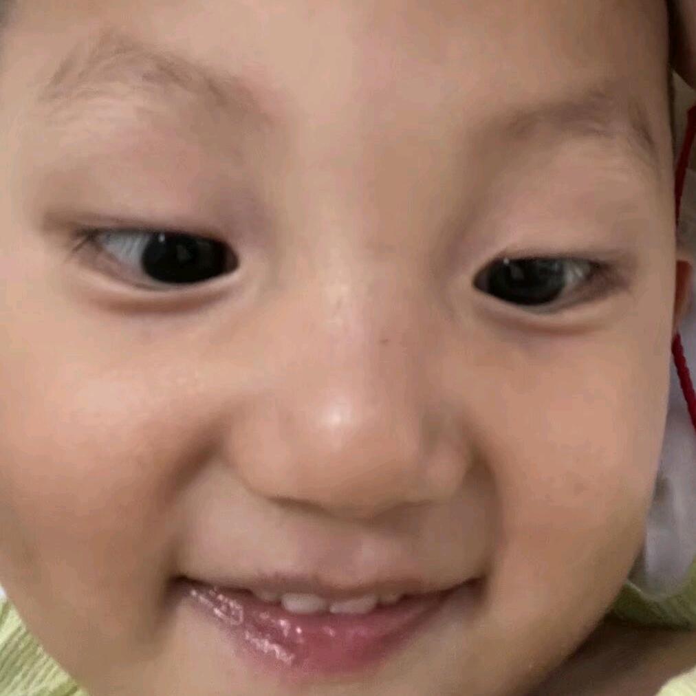 NING