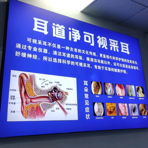耳道净可视采耳官方号