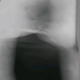 👉🏻