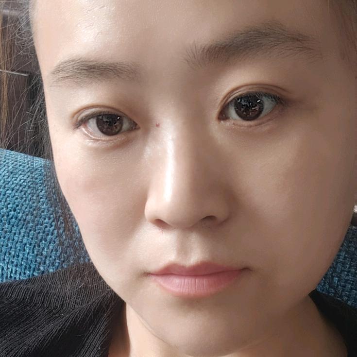 转