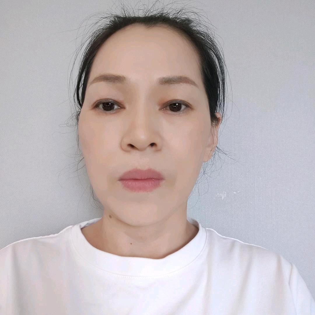 慧慧