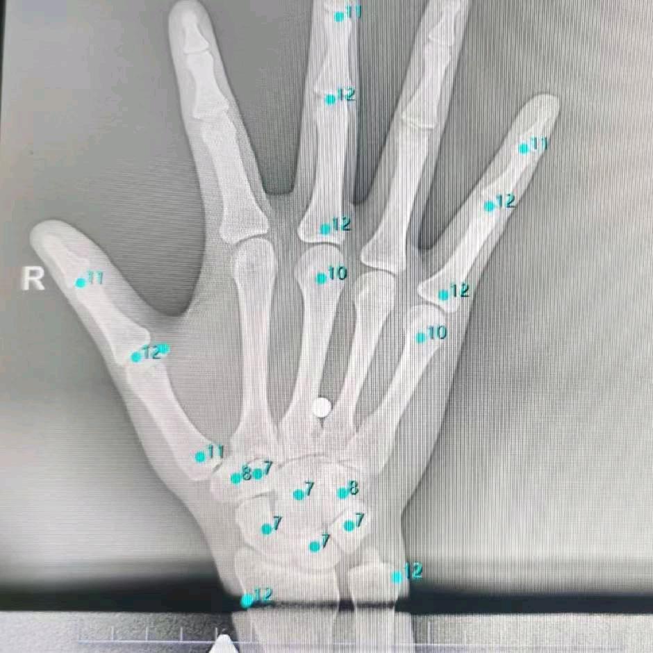 福州长乐儿童身高成长中心