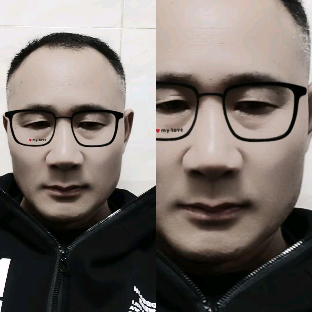 为了生活继续努力