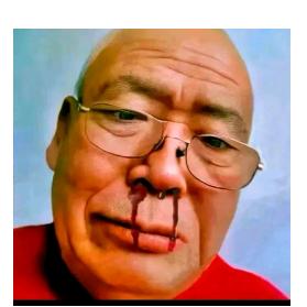 孤单圆柱体