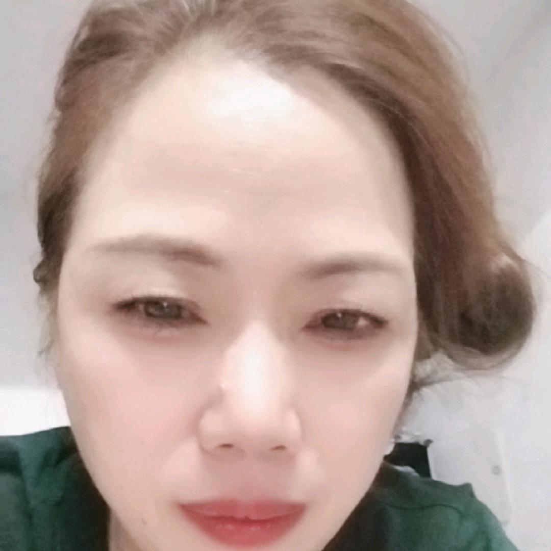 xmz