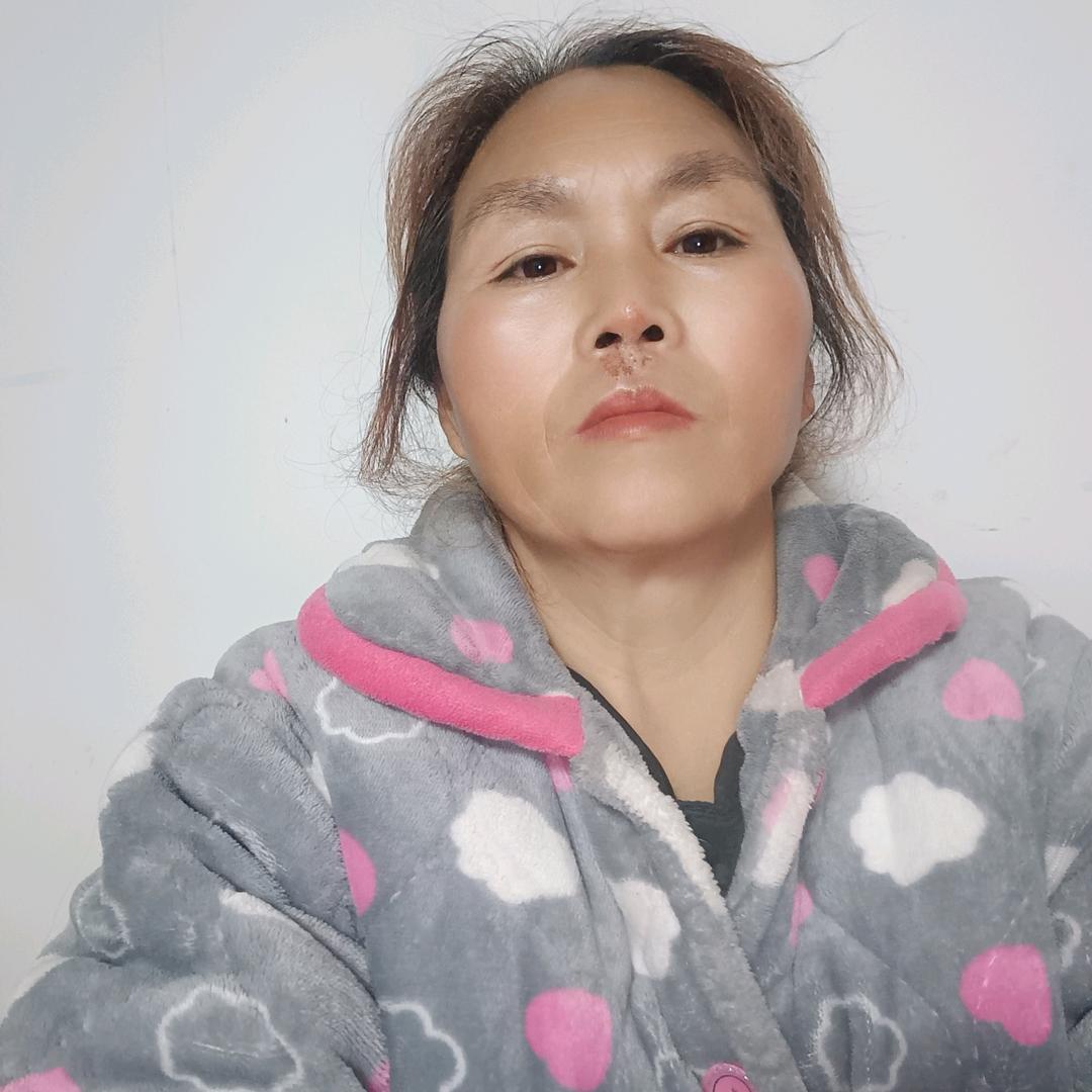 农村黄姐