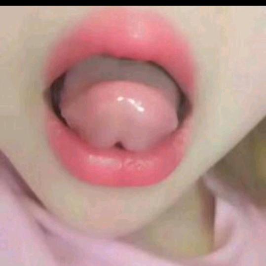 张
