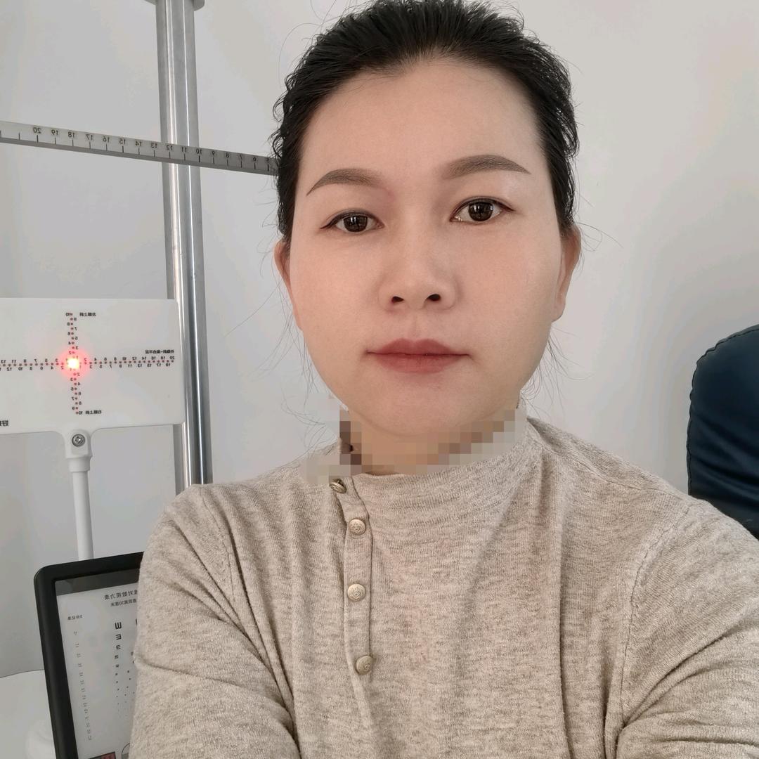 漯河瞳仁眼视光