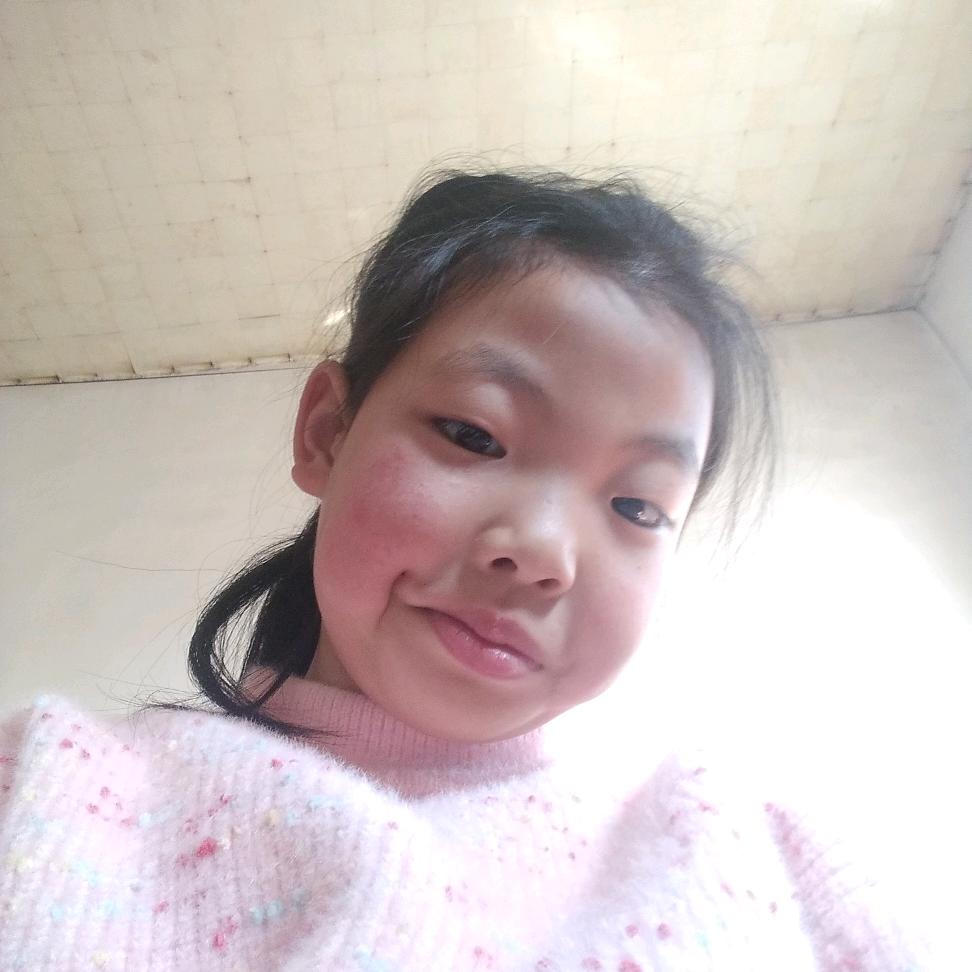 小宝