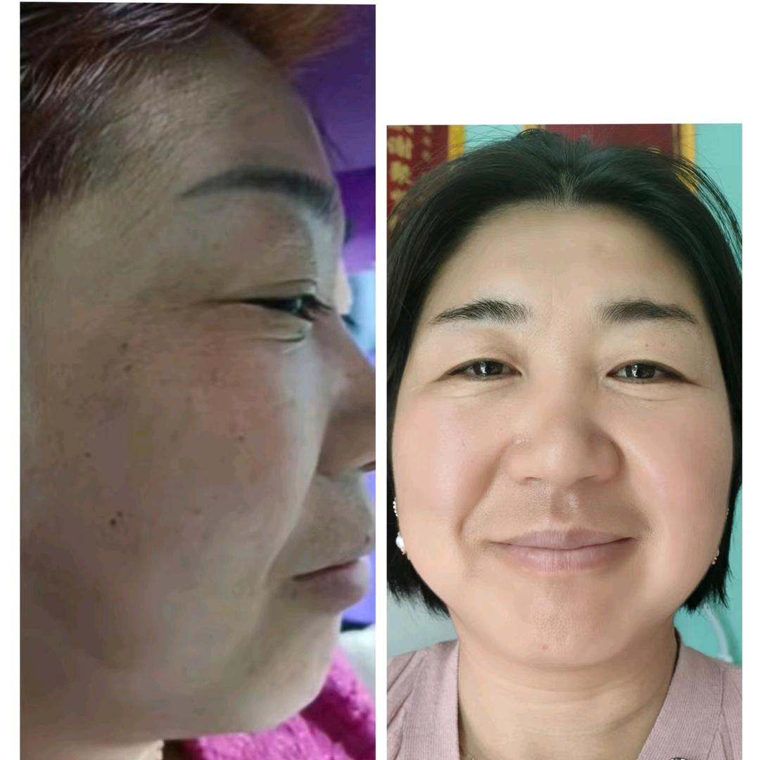 武陟  视力养护