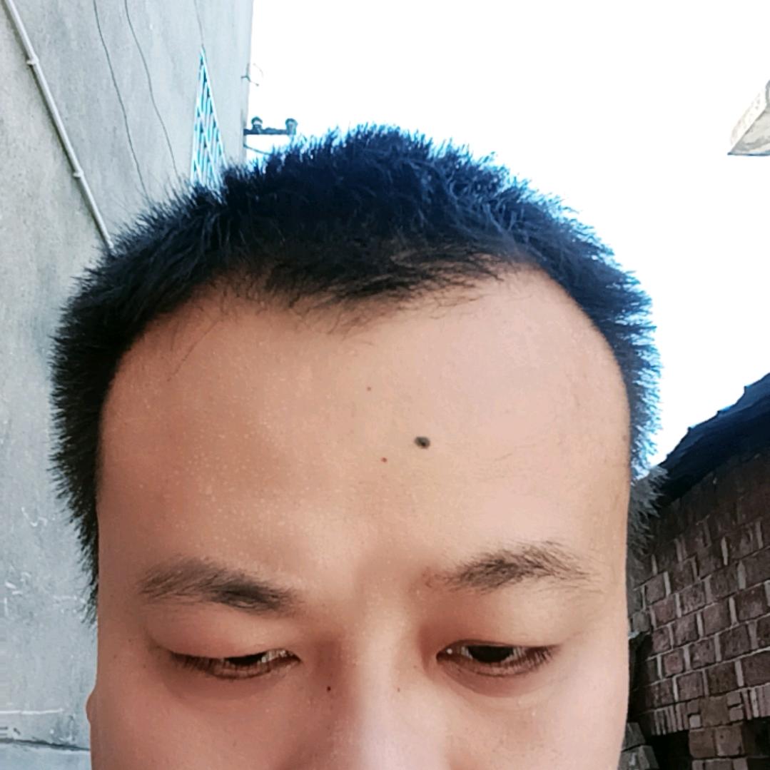 陈哥