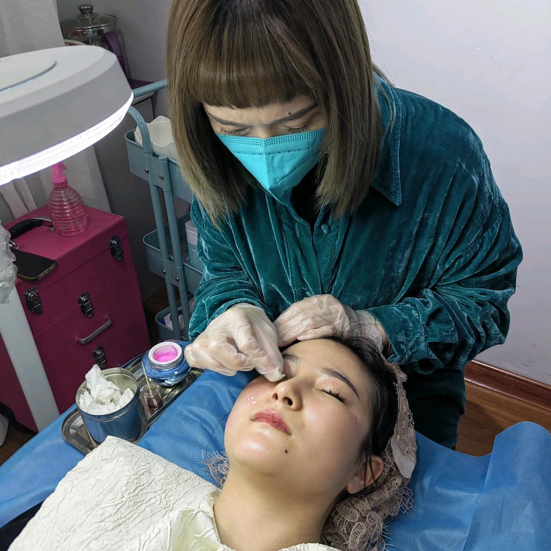 伊犁黎姐点痣祛斑