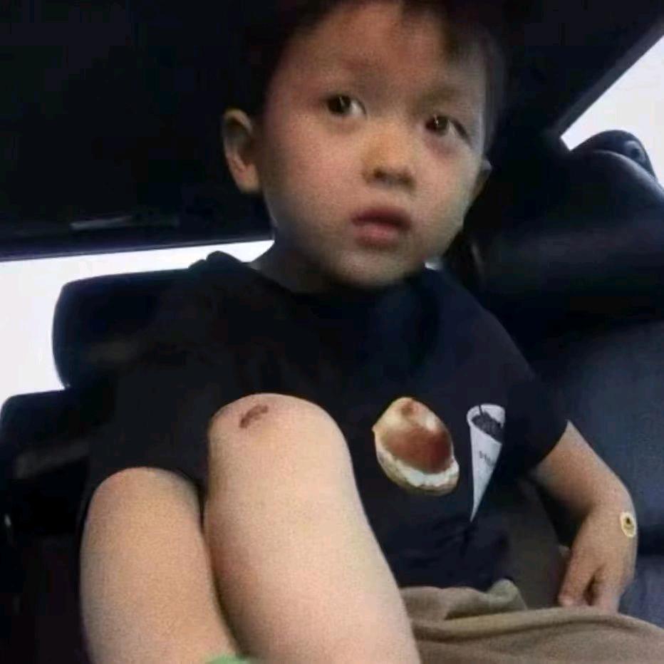 你