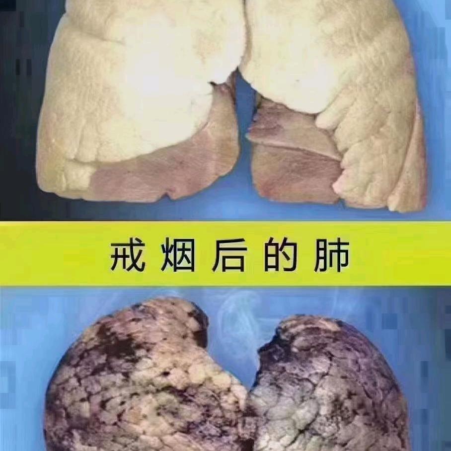 小王聊戒烟