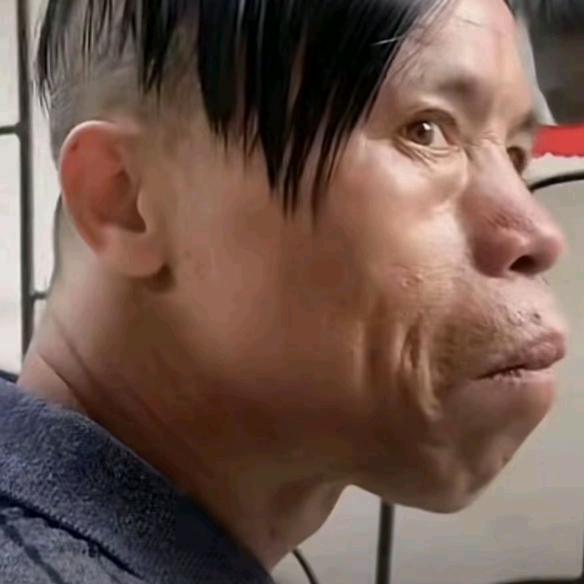 符肿桶