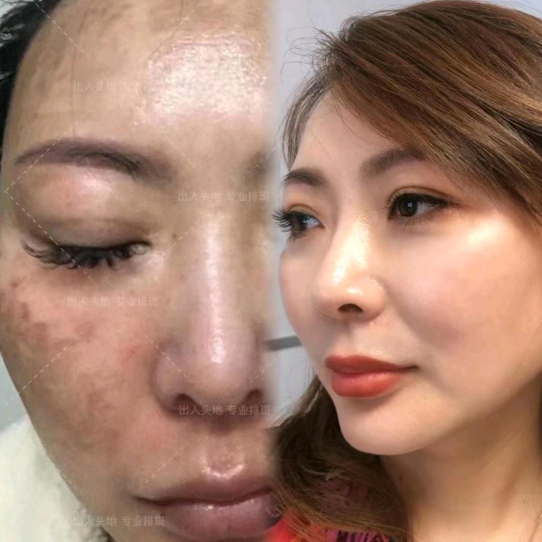 焕瑟北京金金绝斑3