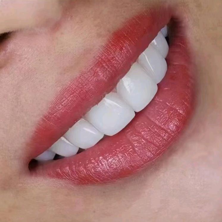 似水年华—美牙