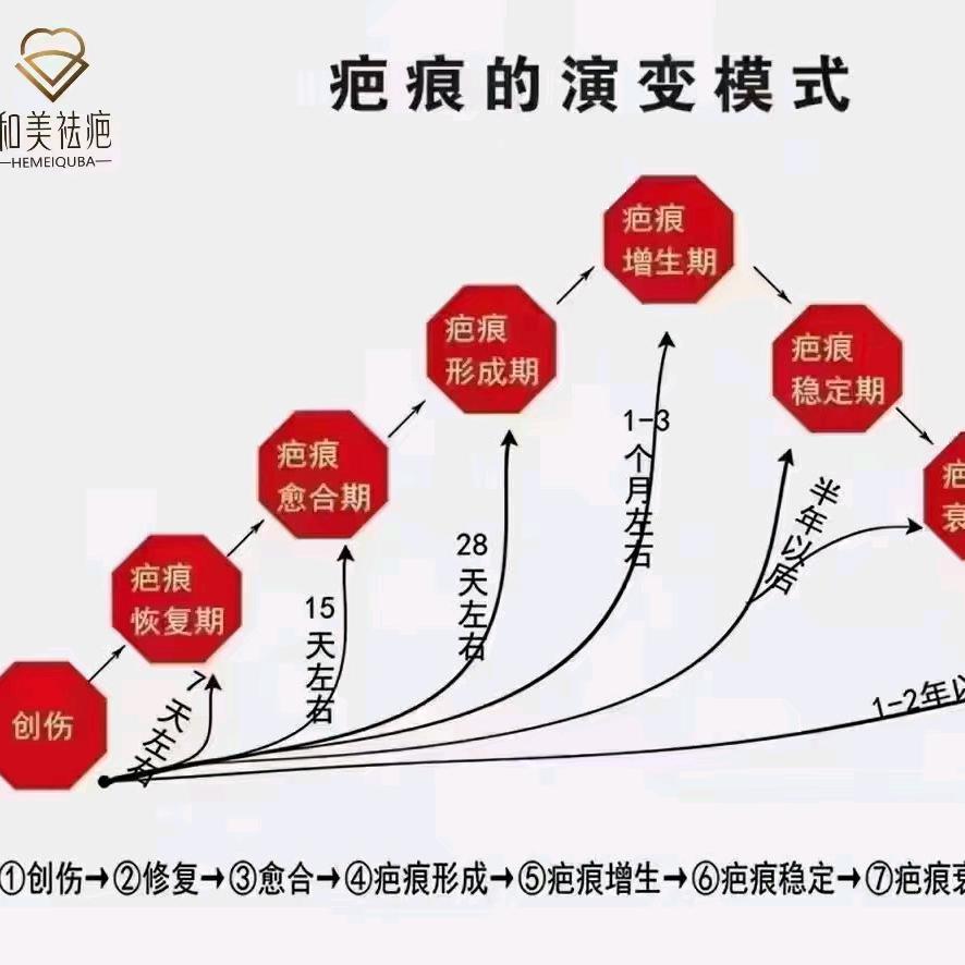 纯中药巴痕修复