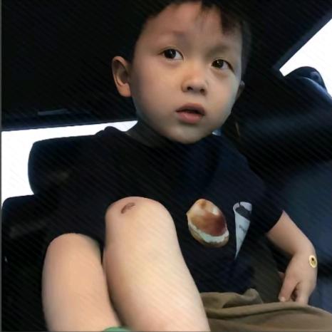 有点小u伤.