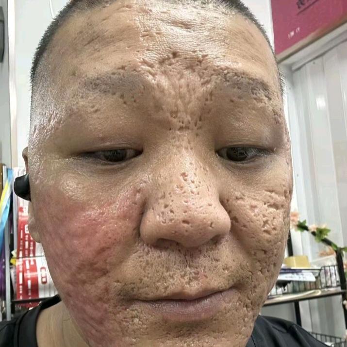 ⊥¹⁸3♭钢板