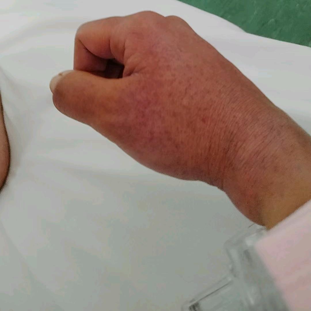 照影后的日常生活