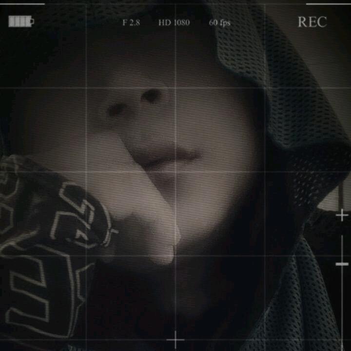 掉了毛的狗（赵）