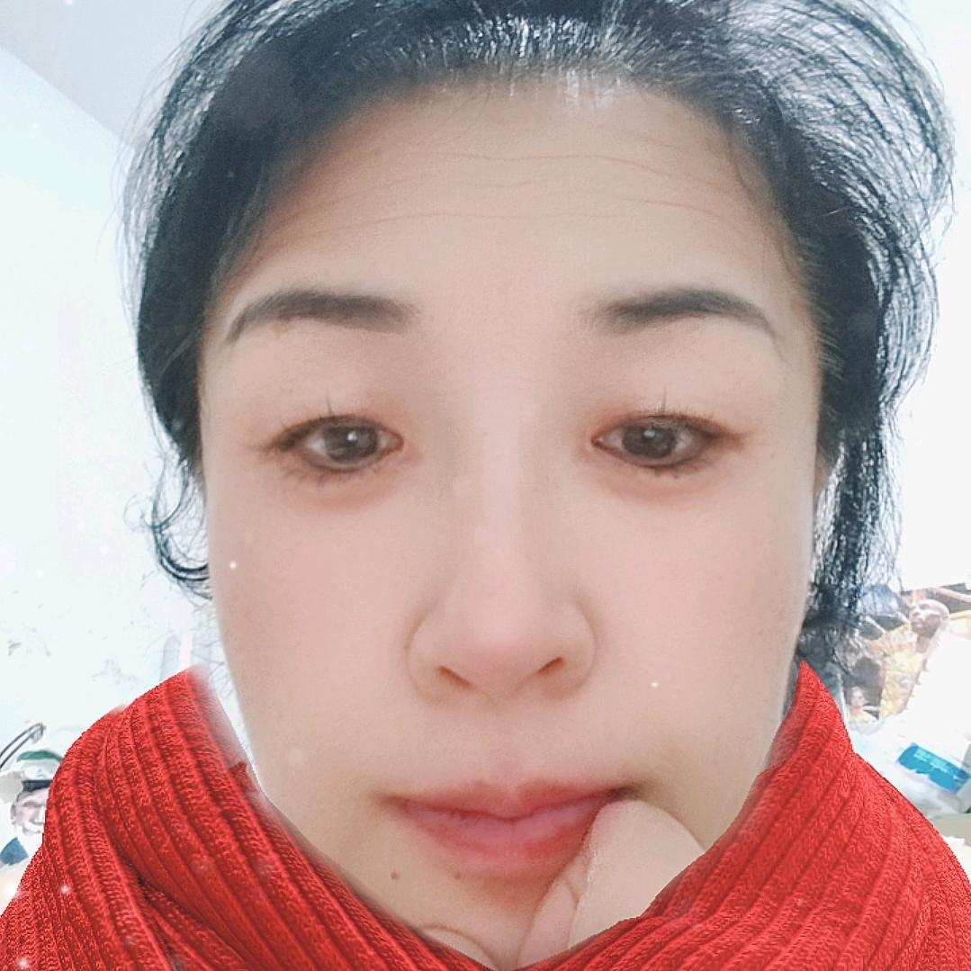 虎牙