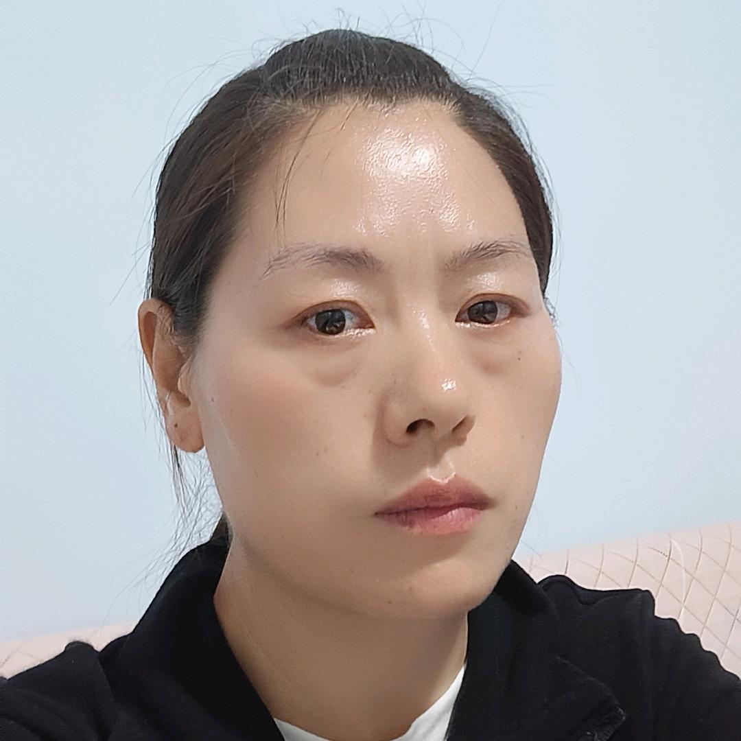 慧姐