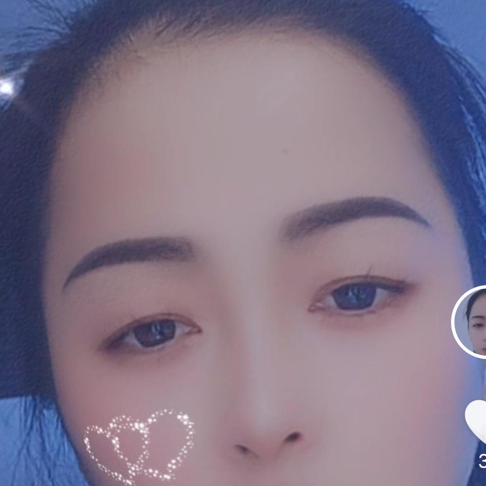 永久