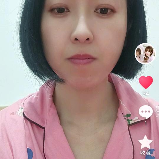 张
