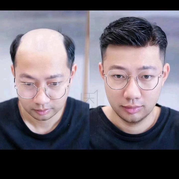 皓斌高端男女假发定制（收长发）