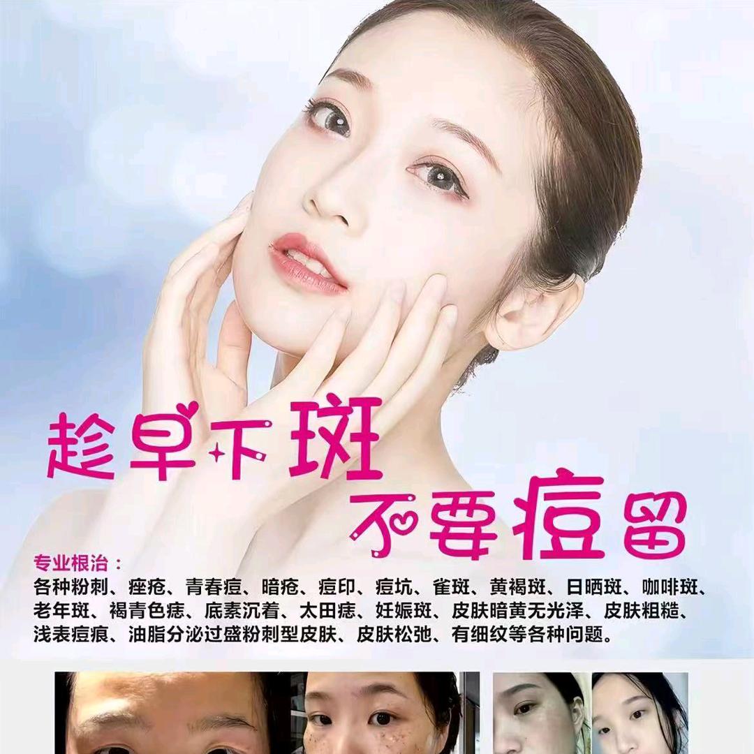 专业祛斑